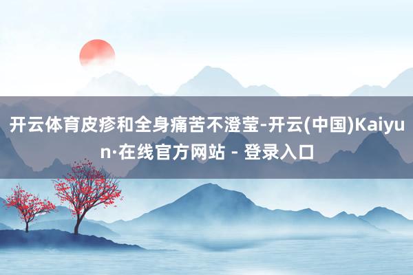 开云体育皮疹和全身痛苦不澄莹-开云(中国)Kaiyun·在线官方网站 - 登录入口
